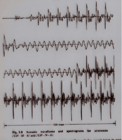 Figure 1 for Comparing Conventional Pitch Detection Algorithms with a Neural Network Approach