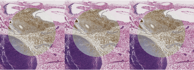 Figure 2 for Robust, fast and accurate: a 3-step method for automatic histological image registration