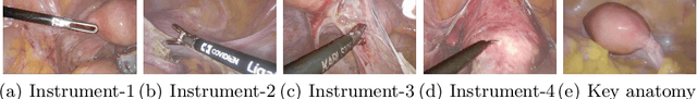 Figure 4 for AutoLaparo: A New Dataset of Integrated Multi-tasks for Image-guided Surgical Automation in Laparoscopic Hysterectomy