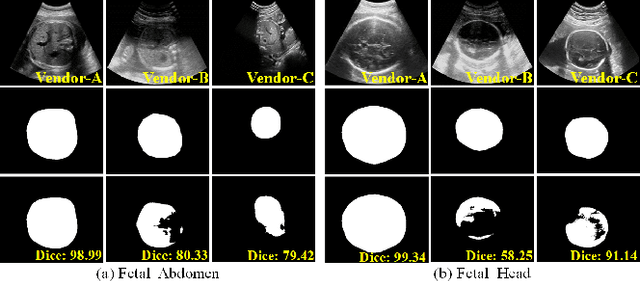 Figure 1 for Generalize Ultrasound Image Segmentation via Instant and Plug & Play Style Transfer