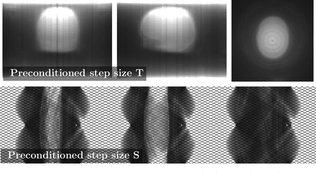 Figure 1 for Faster PET Reconstruction with Non-Smooth Priors by Randomization and Preconditioning