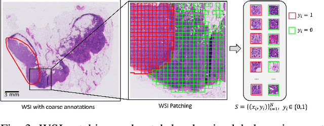 Figure 4 for Label Cleaning Multiple Instance Learning: Refining Coarse Annotations on Single Whole-Slide Images