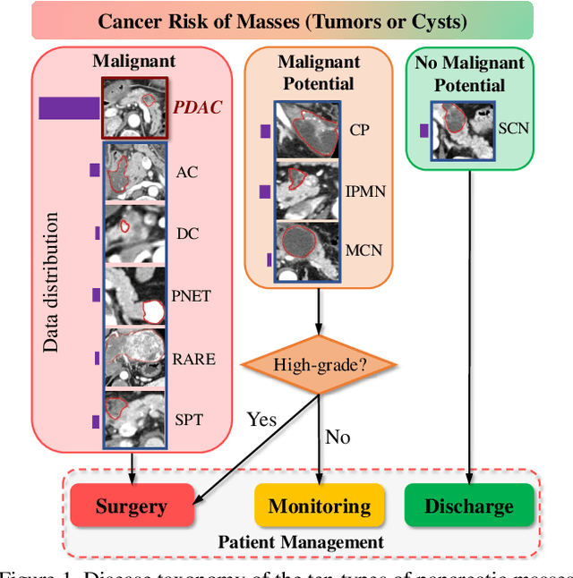 Figure 1 for 3D Graph Anatomy Geometry-Integrated Network for Pancreatic Mass Segmentation, Diagnosis, and Quantitative Patient Management