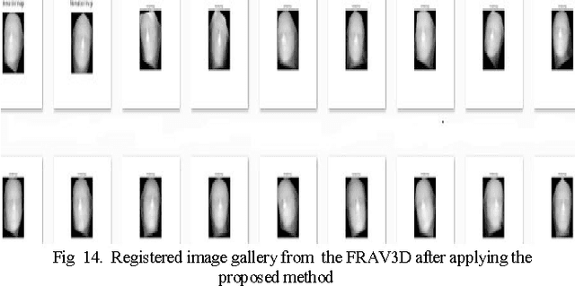 Figure 2 for A method for nose-tip based 3D face registration using maximum intensity algorithm