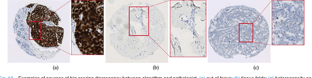 Figure 4 for An End-to-End Deep Learning Histochemical Scoring System for Breast Cancer Tissue Microarray