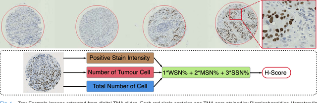 Figure 1 for An End-to-End Deep Learning Histochemical Scoring System for Breast Cancer Tissue Microarray