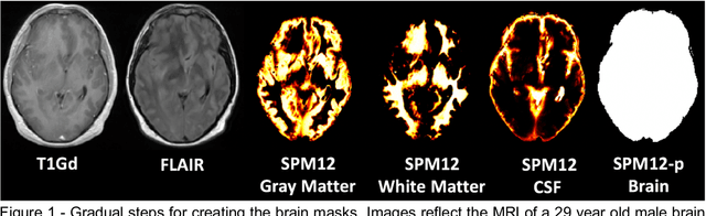 Figure 1 for Robust Automatic Whole Brain Extraction on Magnetic Resonance Imaging of Brain Tumor Patients using Dense-Vnet