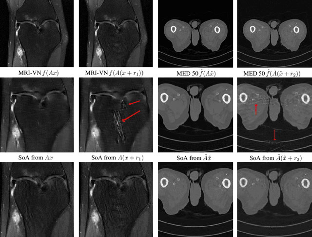 Figure 4 for On instabilities of deep learning in image reconstruction - Does AI come at a cost?