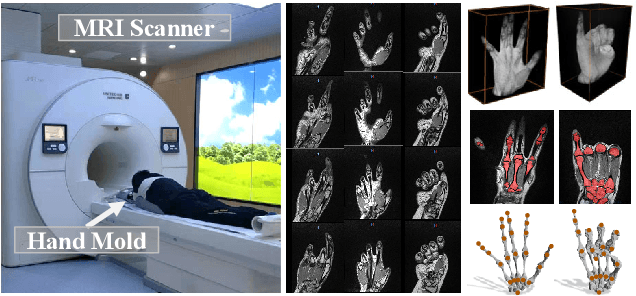Figure 3 for PIANO: A Parametric Hand Bone Model from Magnetic Resonance Imaging