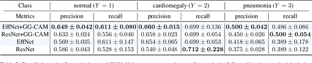Figure 4 for Gaze-Guided Class Activation Mapping: Leveraging Human Attention for Network Attention in Chest X-rays Classification