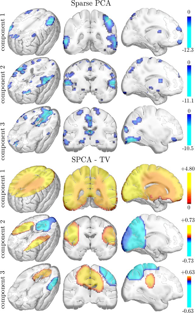 Figure 3 for Structured Sparse Principal Components Analysis with the TV-Elastic Net penalty