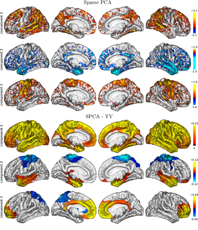 Figure 4 for Structured Sparse Principal Components Analysis with the TV-Elastic Net penalty