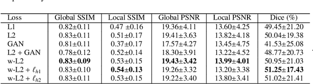 Figure 2 for Automatic Ischemic Stroke Lesion Segmentation from Computed Tomography Perfusion Images by Image Synthesis and Attention-Based Deep Neural Networks