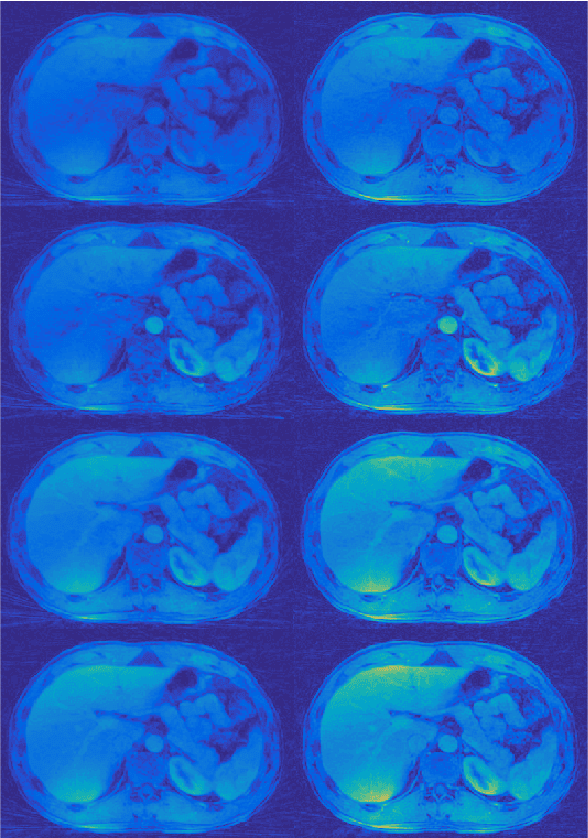Figure 2 for Proceedings of the third "international Traveling Workshop on Interactions between Sparse models and Technology"