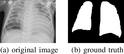 Figure 3 for Calibrated Bagging Deep Learning for Image Semantic Segmentation: A Case Study on COVID-19 Chest X-ray Image