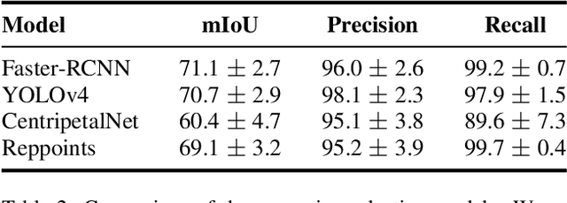 Figure 4 for Surpassing the Human Accuracy: Detecting Gallbladder Cancer from USG Images with Curriculum Learning