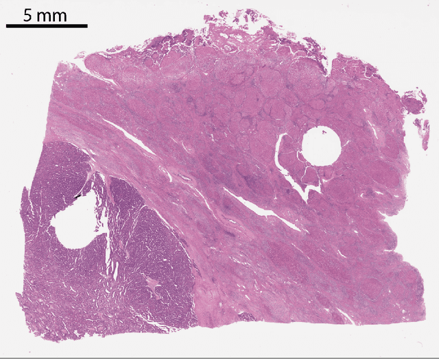 Figure 1 for Multi-scale fully convolutional neural networks for histopathology image segmentation: from nuclear aberrations to the global tissue architecture