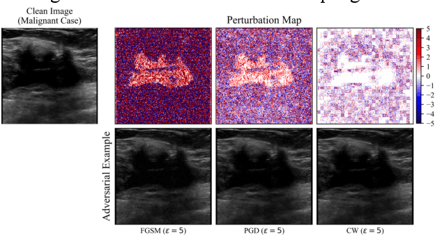 Figure 1 for MIRST-DM: Multi-Instance RST with Drop-Max Layer for Robust Classification of Breast Cancer