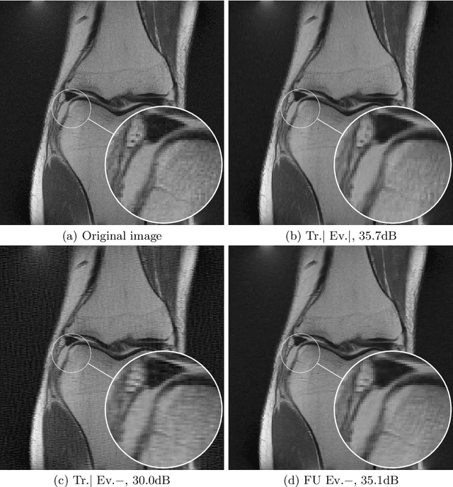 Figure 4 for Training Adaptive Reconstruction Networks for Inverse Problems