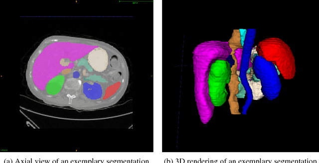 Figure 1 for DLTK: State of the Art Reference Implementations for Deep Learning on Medical Images