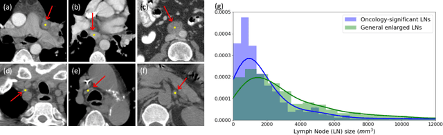 Figure 1 for Detecting Scatteredly-Distributed, Small, andCritically Important Objects in 3D OncologyImaging via Decision Stratification