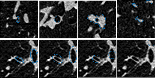 Figure 4 for Early Experiences with Crowdsourcing Airway Annotations in Chest CT