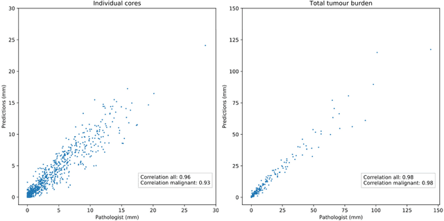 Figure 4 for Pathologist-Level Grading of Prostate Biopsies with Artificial Intelligence