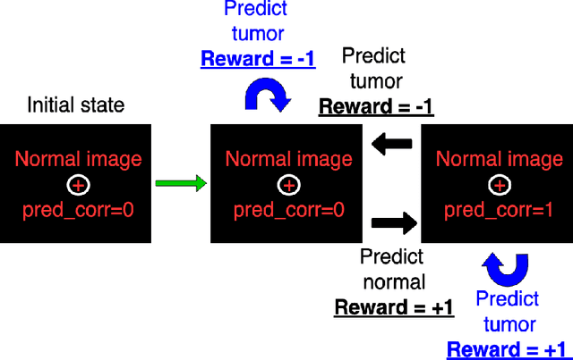 Figure 2 for Deep reinforcement learning with automated label extraction from clinical reports accurately classifies 3D MRI brain volumes