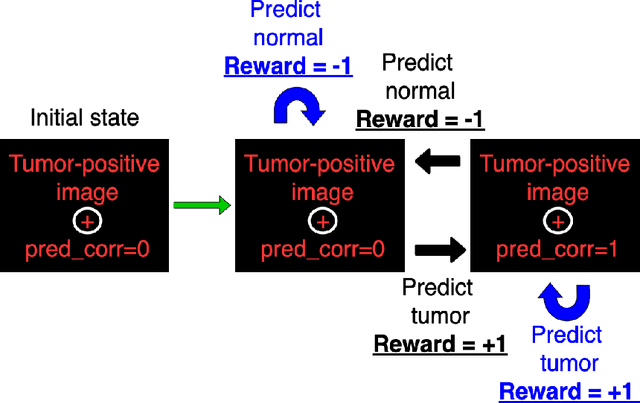 Figure 3 for Deep reinforcement learning with automated label extraction from clinical reports accurately classifies 3D MRI brain volumes