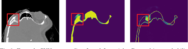 Figure 3 for Segmentation of Defective Skulls from CT Data for Tissue Modelling