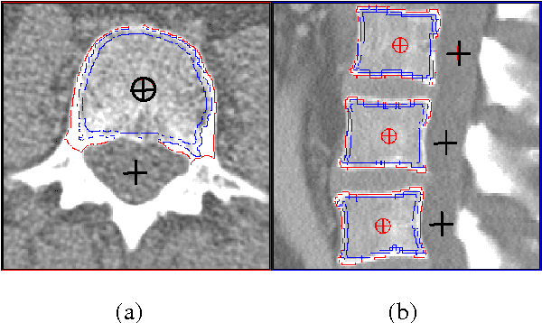 Figure 1 for A New 3D Segmentation Technique for QCT Scans of the Lumbar Spine to Determine BMD and Vertebral Geometry