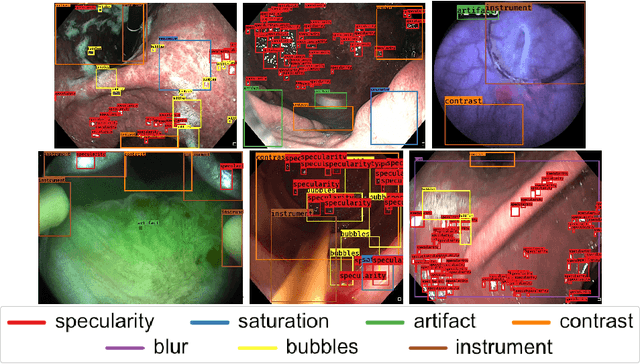 Figure 2 for Endoscopy artifact detection (EAD 2019) challenge dataset