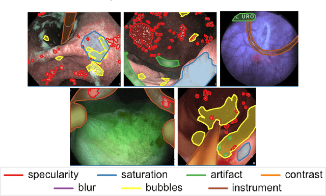 Figure 3 for Endoscopy artifact detection (EAD 2019) challenge dataset