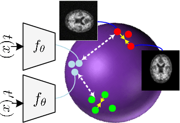 Figure 3 for Multi-Modal Hypergraph Diffusion Network with Dual Prior for Alzheimer Classification