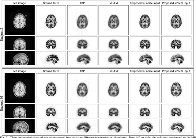 Figure 2 for Direct PET Image Reconstruction Incorporating Deep Image Prior and a Forward Projection Model