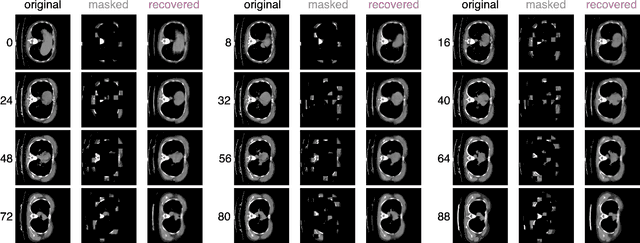 Figure 3 for Masked Image Modeling Advances 3D Medical Image Analysis
