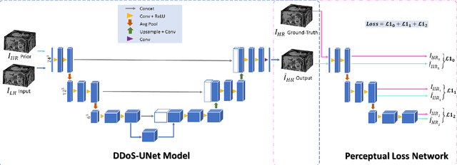 Figure 1 for DDoS-UNet: Incorporating temporal information using Dynamic Dual-channel UNet for enhancing super-resolution of dynamic MRI