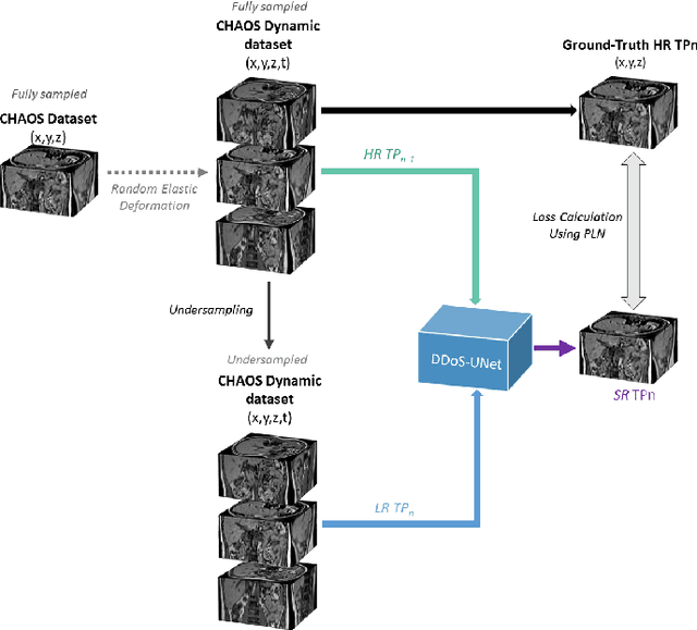 Figure 4 for DDoS-UNet: Incorporating temporal information using Dynamic Dual-channel UNet for enhancing super-resolution of dynamic MRI