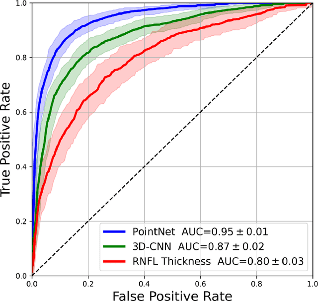Figure 3 for Medical Application of Geometric Deep Learning for the Diagnosis of Glaucoma