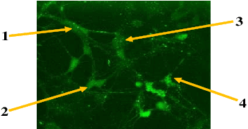 Figure 1 for Information Content in Neuronal Calcium Spike Trains: Entropy Rate Estimation based on Empirical Probabilities