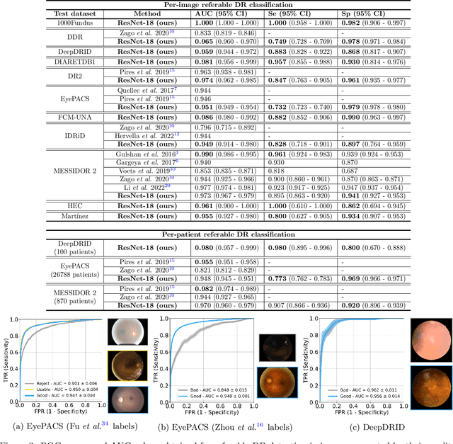 Figure 4 for A ResNet is All You Need? Modeling A Strong Baseline for Detecting Referable Diabetic Retinopathy in Fundus Images