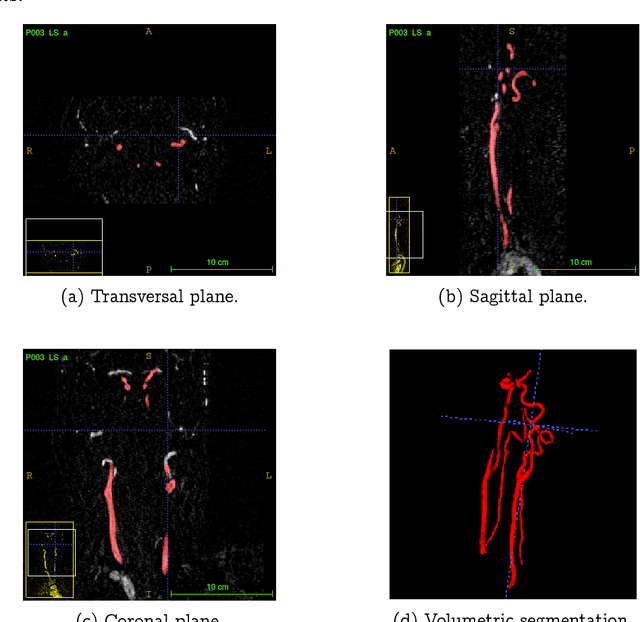 Figure 2 for Projection-Based 2.5D U-net Architecture for Fast Volumetric Segmentation