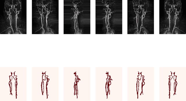 Figure 3 for Projection-Based 2.5D U-net Architecture for Fast Volumetric Segmentation