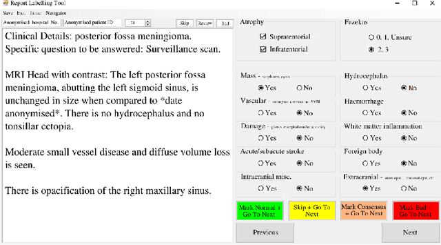 Figure 3 for Labelling imaging datasets on the basis of neuroradiology reports: a validation study