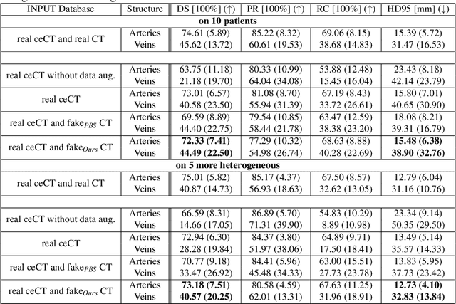 Figure 4 for Anatomically constrained CT image translation for heterogeneous blood vessel segmentation