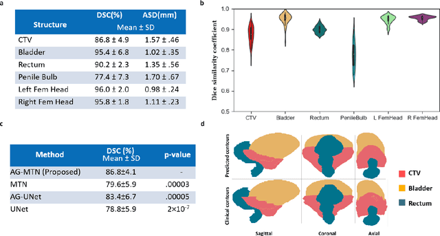 Figure 2 for A deep learning-based framework for segmenting invisible clinical target volumes with estimated uncertainties for post-operative prostate cancer radiotherapy