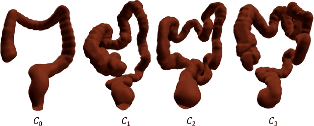 Figure 2 for Colonoscopy Navigation using End-to-End Deep Visuomotor Control: A User Study