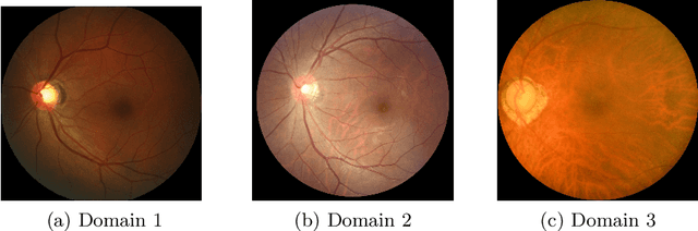 Figure 1 for EyeLoveGAN: Exploiting domain-shifts to boost network learning with cycleGANs