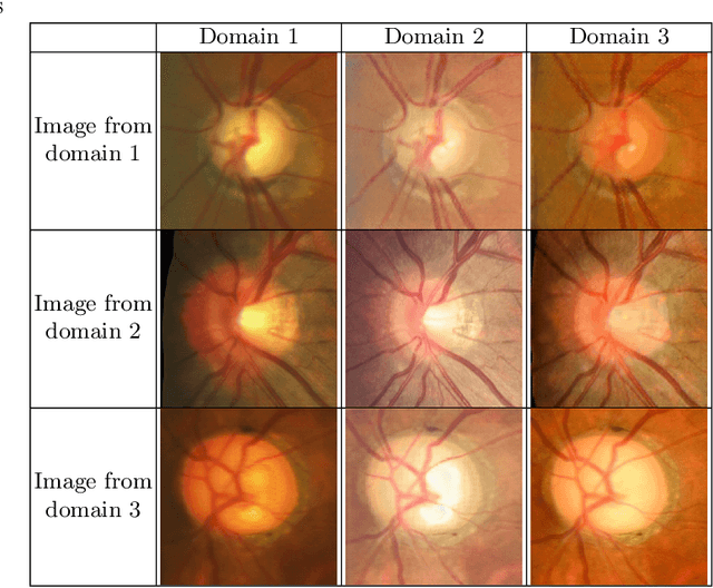 Figure 2 for EyeLoveGAN: Exploiting domain-shifts to boost network learning with cycleGANs