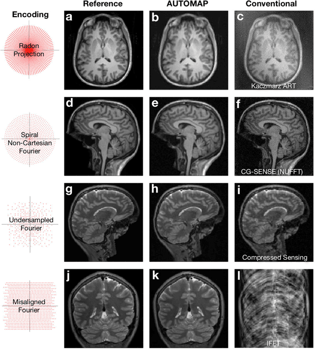 Figure 2 for Image reconstruction by domain transform manifold learning
